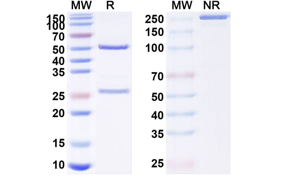 SDS-PAGE - Anti-RANKL Antibody [GB223] Biosimilar - BSA and Azide free (A340227) - Antibodies.com