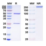 SDS-PAGE - Anti-RANKL Antibody [MW32] Biosimilar - BSA and Azide free (A340229) - Antibodies.com