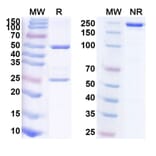 SDS-PAGE - Anti-ROR1 Antibody [LCB 71] Biosimilar - BSA and Azide free (A340233) - Antibodies.com