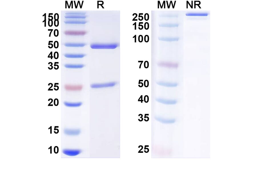 SDS-PAGE - Anti-SARS-CoV-2 Spike Protein Glycoprotein Antibody [ADM382] Biosimilar - BSA and Azide free (A340243) - Antibodies.com