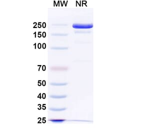 SDS-PAGE - Anti-Tau Antibody [E2814] Biosimilar - BSA and Azide free (A340271) - Antibodies.com