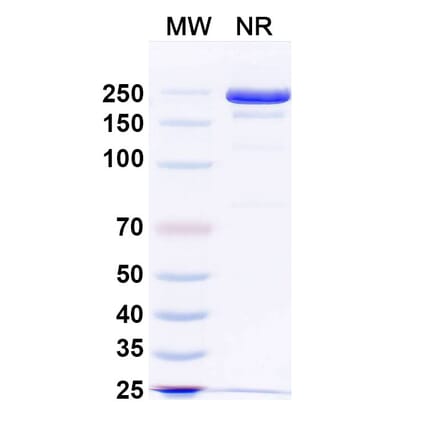 SDS-PAGE - Anti-Tau Antibody [E2814] Biosimilar - BSA and Azide free (A340271) - Antibodies.com
