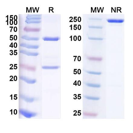 SDS-PAGE - Anti-Tenascin C Antibody [F16-131I] Biosimilar - BSA and Azide free (A340275) - Antibodies.com