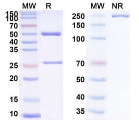 SDS-PAGE - Anti-Tenascin C Antibody [ST2485] Biosimilar - BSA and Azide free (A340276) - Antibodies.com