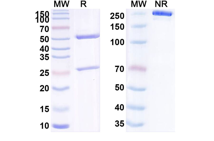 SDS-PAGE - Anti-Tie2 Antibody [UBX25] Biosimilar - BSA and Azide free (A340295) - Antibodies.com