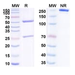 SDS-PAGE - Anti-Tie2 Antibody [UBX25] Biosimilar - BSA and Azide free (A340295) - Antibodies.com