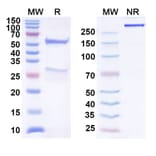 SDS-PAGE - Anti-TIGIT Antibody [BMS 98627] Biosimilar - BSA and Azide free (A340301) - Antibodies.com