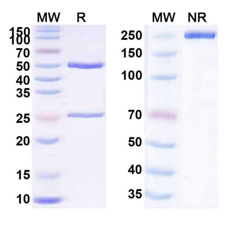 SDS-PAGE - Anti-TIGIT Antibody [TGTB227] Biosimilar - BSA and Azide free (A340304) - Antibodies.com