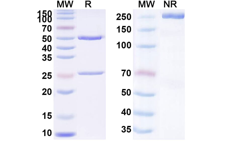 SDS-PAGE - Anti-TIM 1 Antibody [CDX 14] Biosimilar - BSA and Azide free (A340307) - Antibodies.com