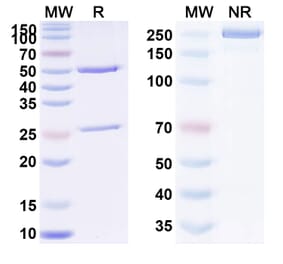 SDS-PAGE - Anti-TNF alpha Antibody [ESBA 15] Biosimilar - BSA and Azide free (A340319) - Antibodies.com