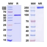 SDS-PAGE - Anti-TNFR1 Antibody [ATROSAB] Biosimilar - BSA and Azide free (A340320) - Antibodies.com