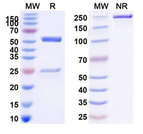 SDS-PAGE - Anti-TNFRSF1B Antibody [BI-191] Biosimilar - BSA and Azide free (A340323) - Antibodies.com