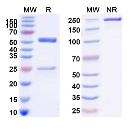 SDS-PAGE - Anti-TNFRSF1B Antibody [BI-191] Biosimilar - BSA and Azide free (A340323) - Antibodies.com