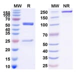SDS-PAGE - Anti-TNFRSF1B Antibody [BI-191] Biosimilar - BSA and Azide free (A340323) - Antibodies.com