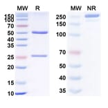 SDS-PAGE - Anti-TNFRSF1B Antibody [BI-188] Biosimilar - BSA and Azide free (A340324) - Antibodies.com