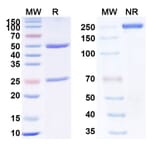 SDS-PAGE - Anti-TNF alpha Antibody [GSK28528] Biosimilar - BSA and Azide free (A340339) - Antibodies.com