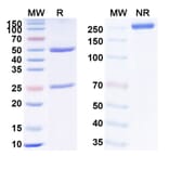 SDS-PAGE - Anti-TNF alpha Antibody [Arthrofoon] Biosimilar - BSA and Azide free (A340342) - Antibodies.com