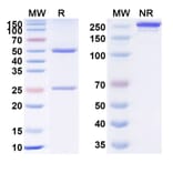 SDS-PAGE - Anti-TNF alpha Antibody [UB-721] Biosimilar - BSA and Azide free (A340349) - Antibodies.com