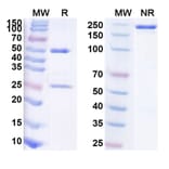 SDS-PAGE - Anti-TNF alpha Antibody [HS16] Biosimilar - BSA and Azide free (A340350) - Antibodies.com