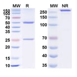 SDS-PAGE - Anti-Prealbumin Antibody [NI-31] Biosimilar - BSA and Azide free (A340354) - Antibodies.com
