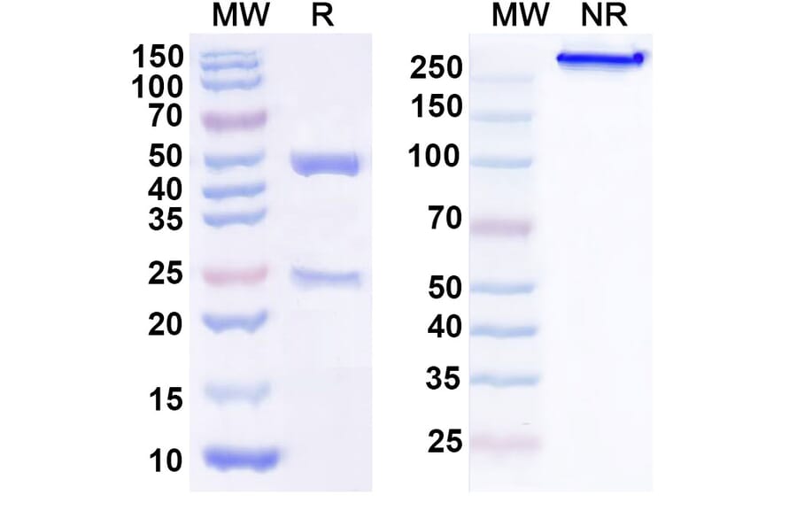 SDS-PAGE - Anti-TSG101 Antibody [FGI-11-1A6] Biosimilar - BSA and Azide free (A340357) - Antibodies.com