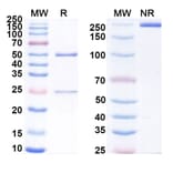 SDS-PAGE - Anti-uPAR Antibody [ATN-658] Biosimilar - BSA and Azide free (A340361) - Antibodies.com