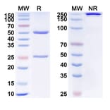 SDS-PAGE - Anti-VEGFA Antibody [VX7] Biosimilar - BSA and Azide free (A340374) - Antibodies.com
