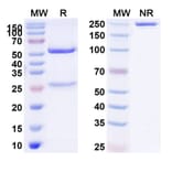 SDS-PAGE - Anti-alpha 2 Antiplasmin Antibody [DS9231] Biosimilar - BSA and Azide free (A340381) - Antibodies.com