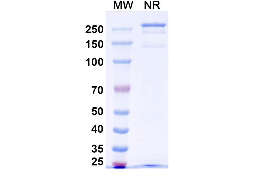 SDS-PAGE - Anti-Netrin 1 Antibody [NP137] Biosimilar - BSA and Azide free (A340390) - Antibodies.com