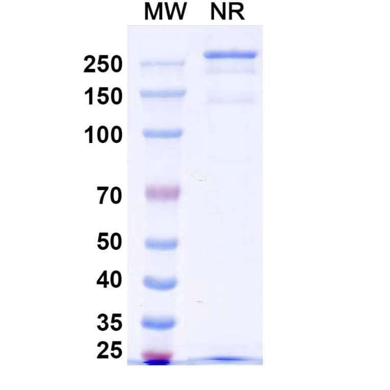 SDS-PAGE - Anti-Netrin 1 Antibody [NP137] Biosimilar - BSA and Azide free (A340390) - Antibodies.com