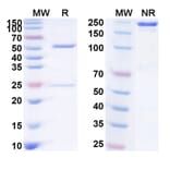Chromatography profile - Anti-NKG2D Antibody [CYAD-2] Biosimilar - BSA and Azide free (A340392) - Antibodies.com