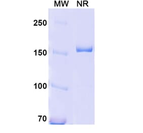 SDS-PAGE - Anti-CD18 Antibody [YFC51.1] Biosimilar - BSA and Azide free (A340419) - Antibodies.com
