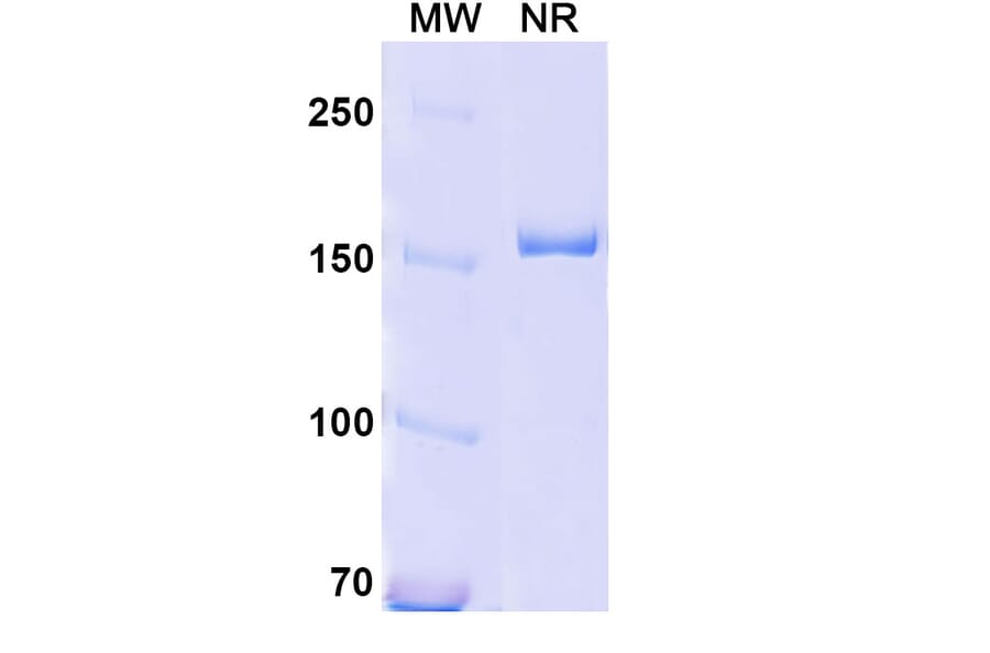 SDS-PAGE - Anti-CD18 Antibody [YFC51.1] Biosimilar - BSA and Azide free (A340419) - Antibodies.com