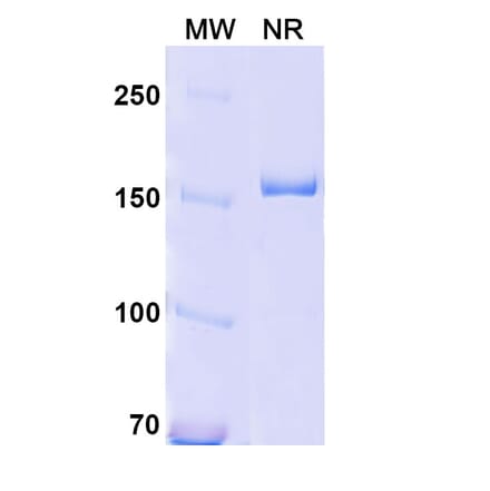 SDS-PAGE - Anti-CD18 Antibody [YFC51.1] Biosimilar - BSA and Azide free (A340419) - Antibodies.com