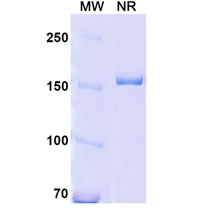 SDS-PAGE - Anti-CD18 Antibody [YFC51.1] Biosimilar - BSA and Azide free (A340419) - Antibodies.com
