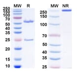 SDS-PAGE - Anti-PSMA Antibody [MT112] Biosimilar - BSA and Azide free (A340433) - Antibodies.com