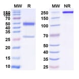 SDS-PAGE - Anti-CD39 Antibody [SRF36] Biosimilar - BSA and Azide free (A340436) - Antibodies.com