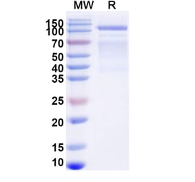 SDS-PAGE - Avalglucosidase alfa Biosimilar - Anti-GAA Antibody - BSA and Azide free (A340443) - Antibodies.com