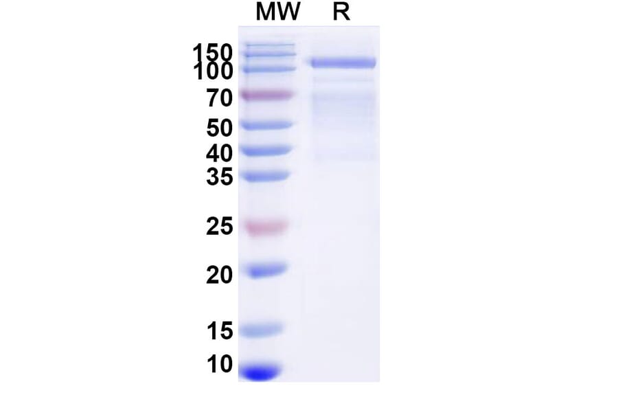 SDS-PAGE - Avalglucosidase alfa Biosimilar - Anti-GAA Antibody - BSA and Azide free (A340443) - Antibodies.com