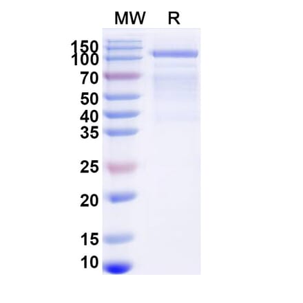 SDS-PAGE - Avalglucosidase alfa Biosimilar - Anti-GAA Antibody - BSA and Azide free (A340443) - Antibodies.com