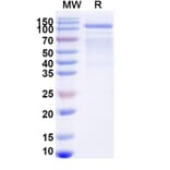 SDS-PAGE - Avalglucosidase alfa Biosimilar - Anti-GAA Antibody - BSA and Azide free (A340443) - Antibodies.com