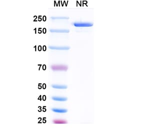 SDS-PAGE - Vopikitug Biosimilar - Anti-CD25 Antibody - BSA and Azide free (A340453) - Antibodies.com