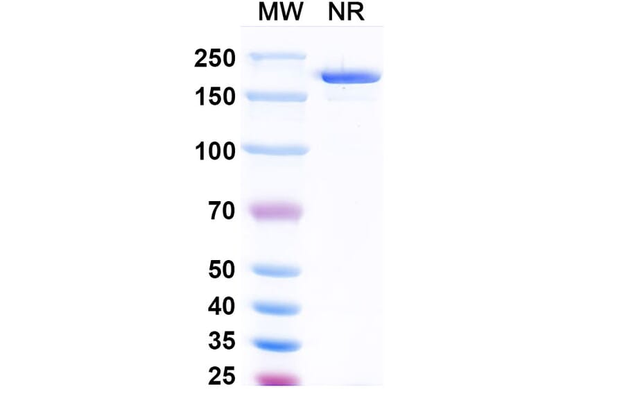 SDS-PAGE - Vopikitug Biosimilar - Anti-CD25 Antibody - BSA and Azide free (A340453) - Antibodies.com