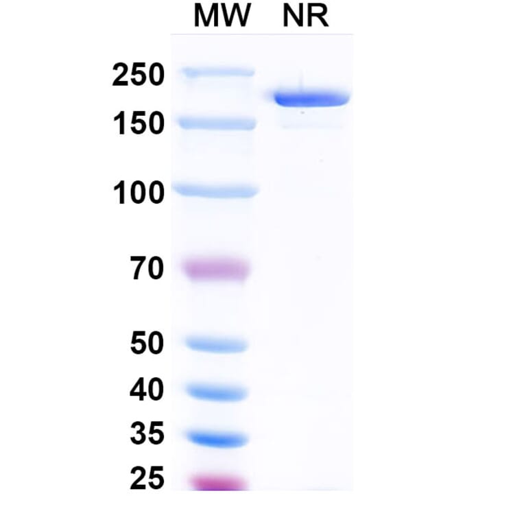 SDS-PAGE - Vopikitug Biosimilar - Anti-CD25 Antibody - BSA and Azide free (A340453) - Antibodies.com