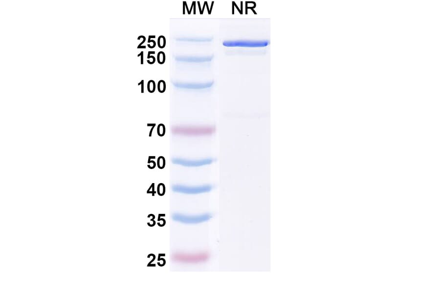 SDS-PAGE - Vopikitug Biosimilar - Anti-CD25 Antibody - BSA and Azide free (A340453) - Antibodies.com