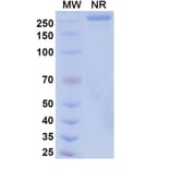 SDS-PAGE - Suvemcitug Biosimilar - Anti-VEGFA Antibody - BSA and Azide free (A340455) - Antibodies.com