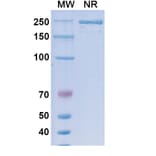 SDS-PAGE - Suvemcitug Biosimilar - Anti-VEGFA Antibody - BSA and Azide free (A340455) - Antibodies.com
