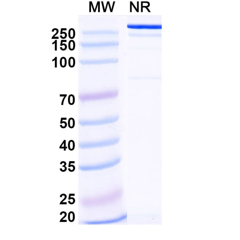 SDS-PAGE - Ersodetug Biosimilar - Anti-Insulin Receptor Antibody - BSA and Azide free (A340460) - Antibodies.com