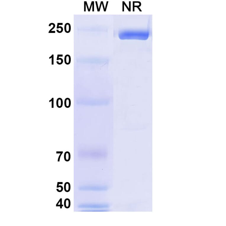 SDS-PAGE - Erzotabart Biosimilar - Anti-CD38 Antibody - BSA and Azide free (A340461) - Antibodies.com