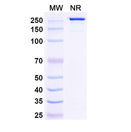 SDS-PAGE - Firastotug Biosimilar - Anti-CTLA-4 Antibody - BSA and Azide free (A340464) - Antibodies.com